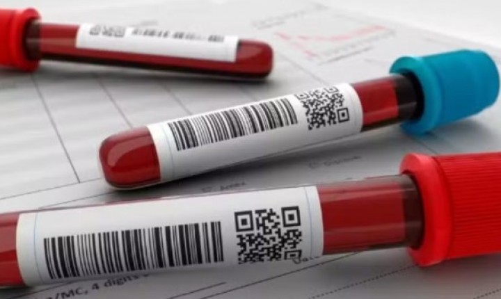 SUS amplia tratamento para leucemia agressiva