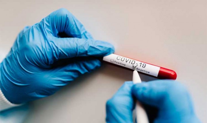 Covid-19 em SC: mais de 200 mil recuperados no Estado