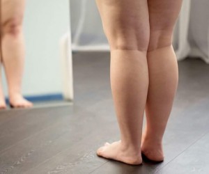 Como a alimentação pode melhorar os sintomas do lipedema