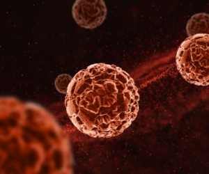 Câncer de sangue pouco conhecido exige atenção