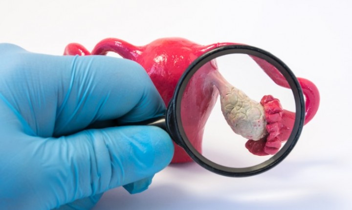 Hipogonadismo pode ser revertido com hábitos saudáveis