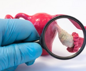 Hipogonadismo pode ser revertido com hábitos saudáveis