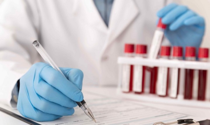 Entenda sobre o tempo ideal de jejum para exames