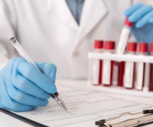 Entenda sobre o tempo ideal de jejum para exames