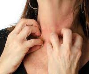 Atenção às alergias que acometem 30% dos brasileiros