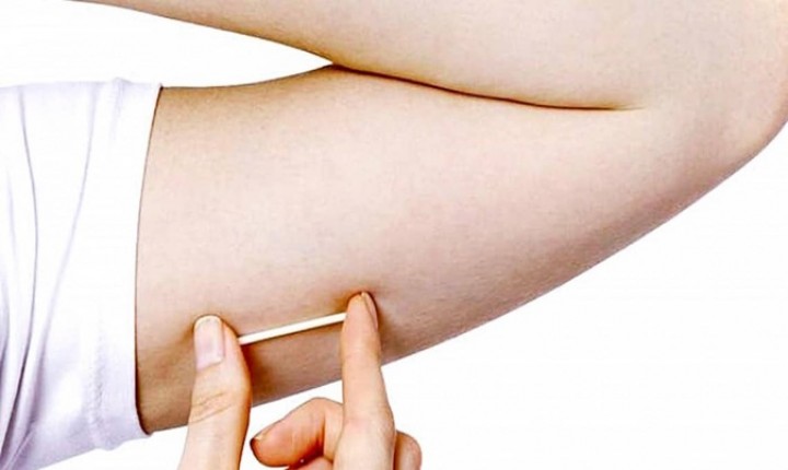 Chip da beleza: uma furada para a sua saúde