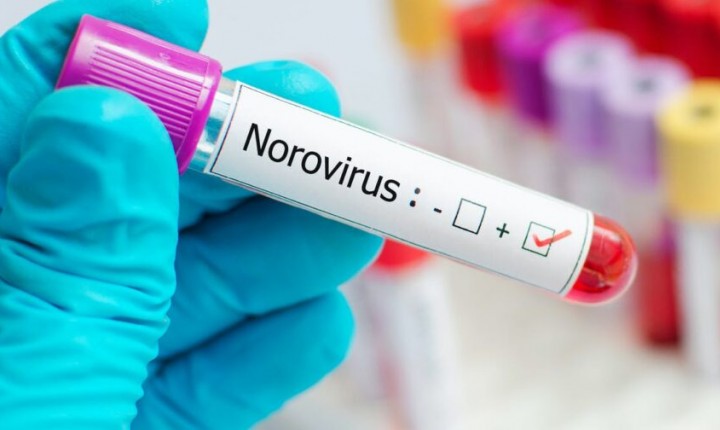 Norovírus é o causador dos quadros de diarreia na Capital, informa PMF