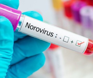 Norovírus é o causador dos quadros de diarreia na Capital, informa PMF