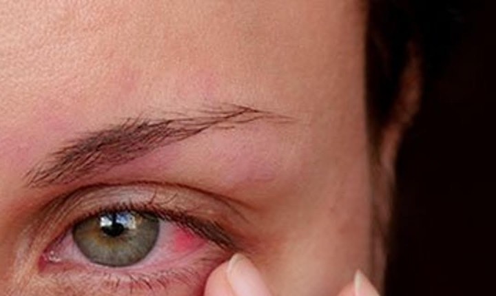 Dengue pode colocar em risco a visão de 1/4 dos brasileiros  